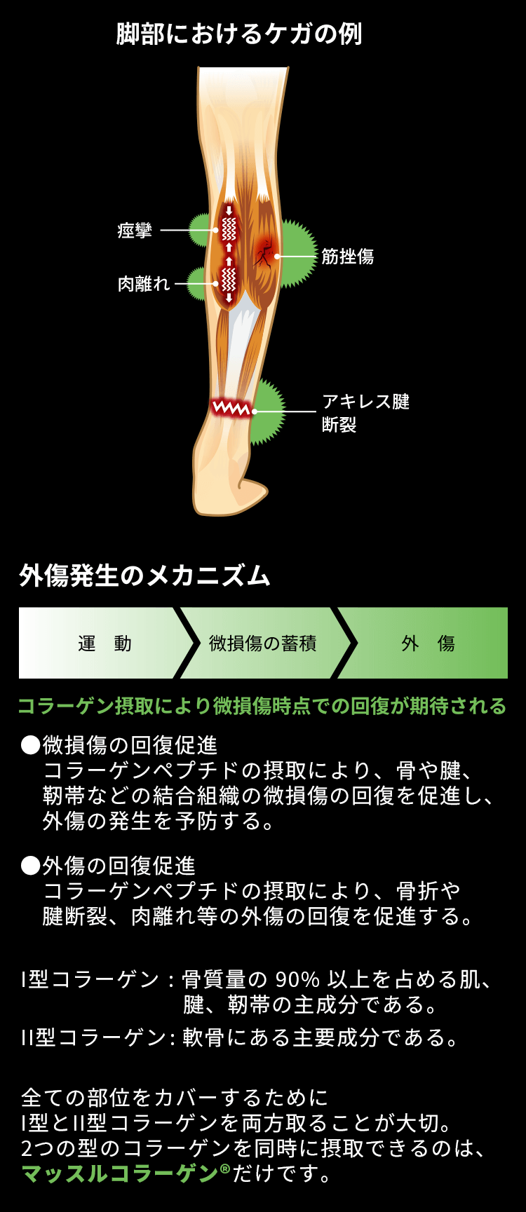 脚部におけるケガの例　外傷発生のメカニズム