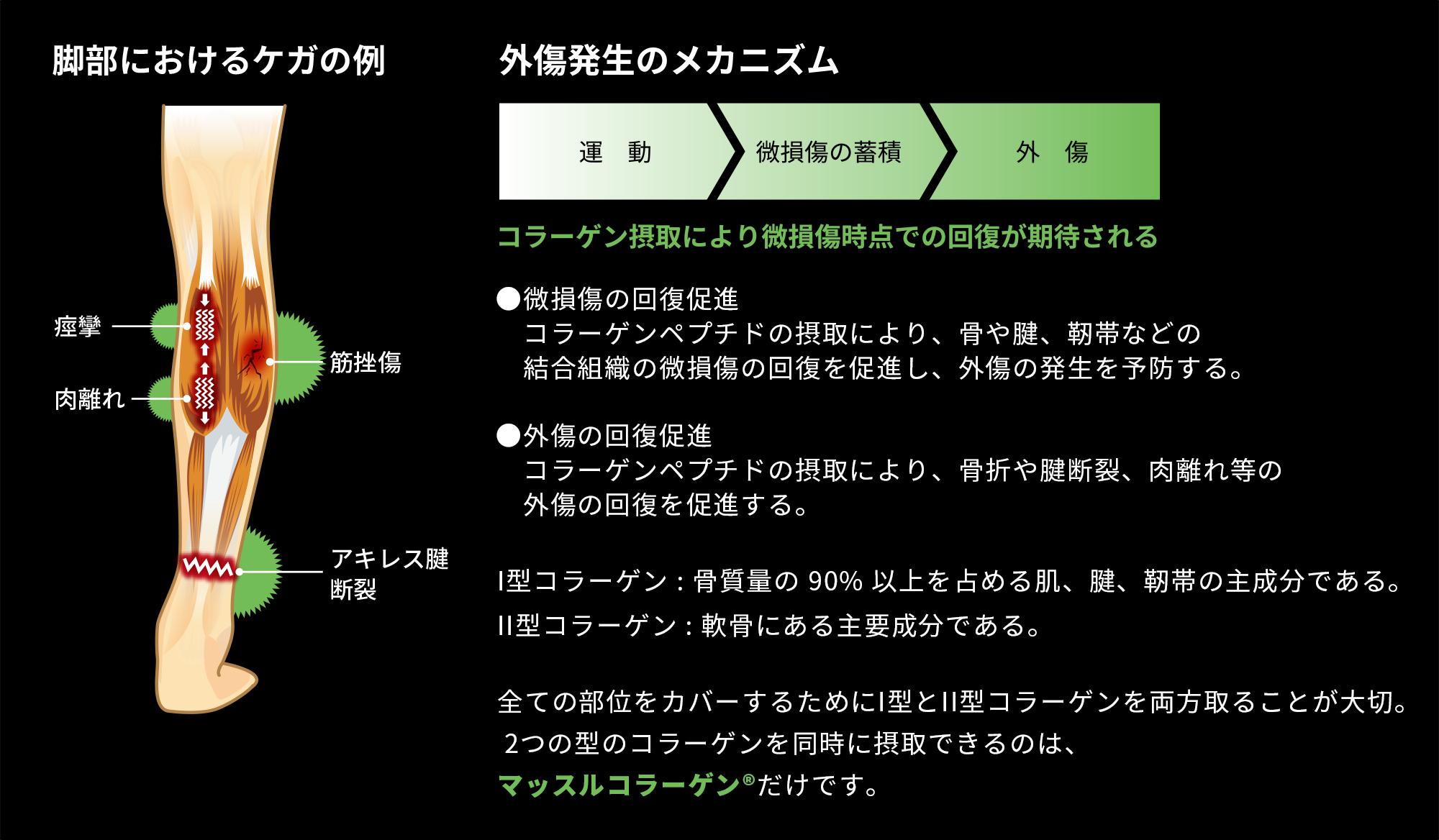 脚部におけるケガの例　外傷発生のメカニズム